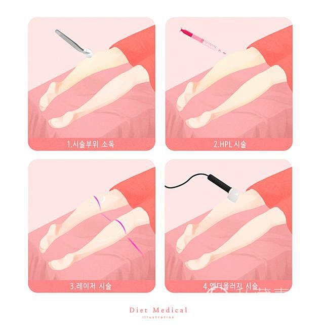 医疗美容整形瘦身减肥脂肪组织人物手绘插画...