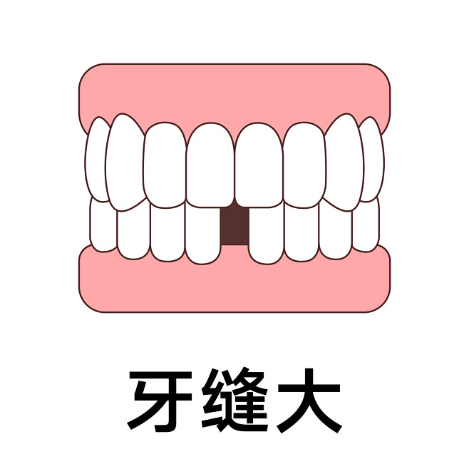 牙缝大