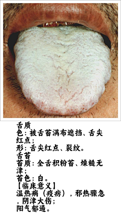 阿宅学医记采集到舌诊图