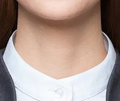 1 (5)