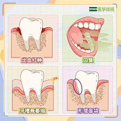 qyfjnl采集到牙素材