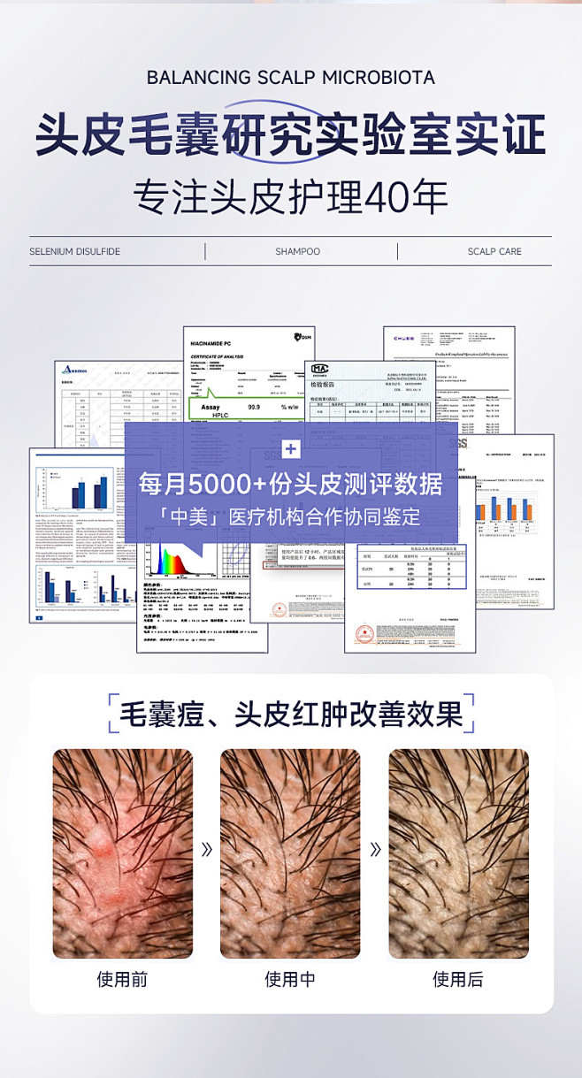 二硫化硒洗头水控油蓬松去屑止痒头皮毛囊炎...