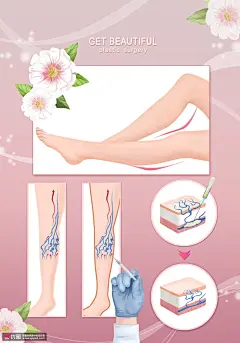 肉毒素注射针剂瘦腿瘦身美女医美整形插画医疗保健素材下载-优图网-UPPSD