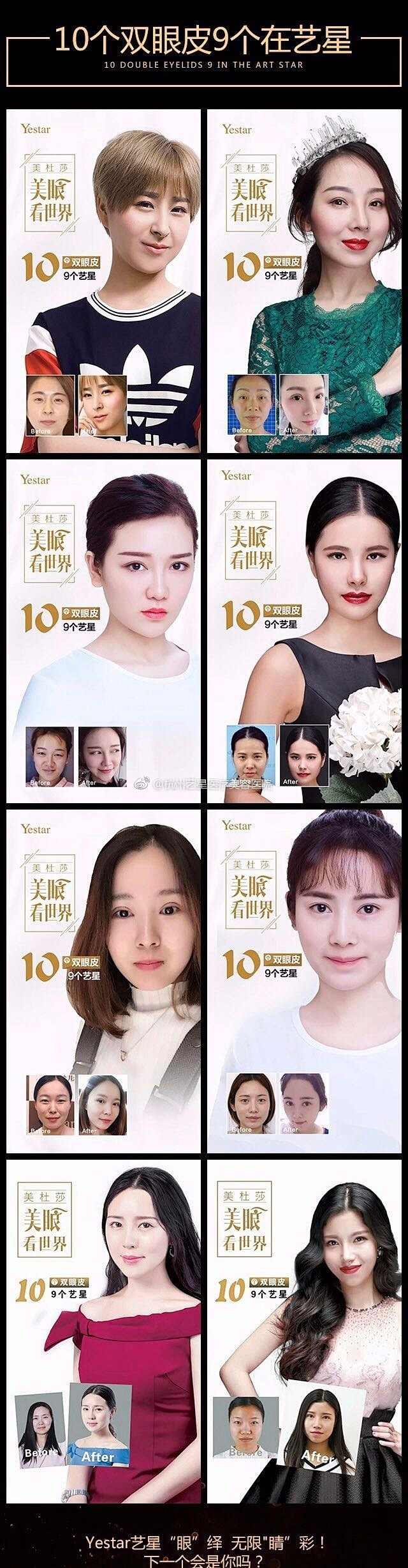 十个双眼皮九个在艺星
   #美杜莎眼#...