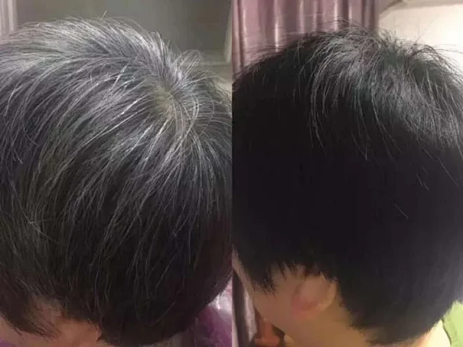 白发转黑对比图的 搜索结果_360图片-花瓣网