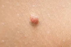 摩尔