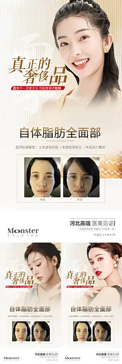 医美自体脂肪案例海报-志设网-zs9.com
