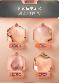 忘만나다采集到详情页_痛点表达