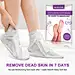 Foot Peel Mask 5 Pack Soft Foot Exfoliating Peeling Scrub Mask Removes Calluses and Dead Skin Cells Repair Rough Heels in 7 Days - Make Your Feet Soft for Women &amp; Men Lavender : Foot Peel Mask 5 Pack Soft Foot Exfoliating Peeling Scrub Mask Removes Ca