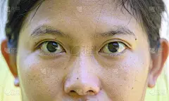 亚洲女人的脸没有化妆。亚洲女性没有整容