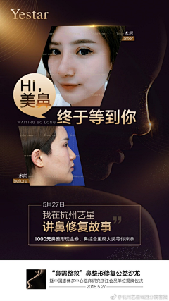 墨_兰采集到鼻整形