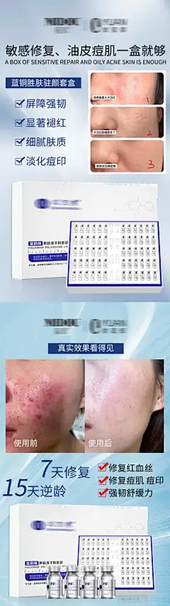 微商冻干粉系列海报_源文件下载_PSD格式_1371X4862像素-海报,冻干粉,微商,问题肌肤,皮肤管理,美妆,美容,医美,化妆品,护肤品-作品编号:2023121417072761-志设-zs9.com