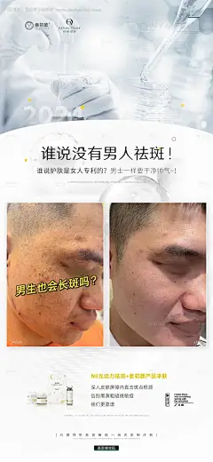 长沙医美美容祛斑美白痘痘模特对比海报-源文件