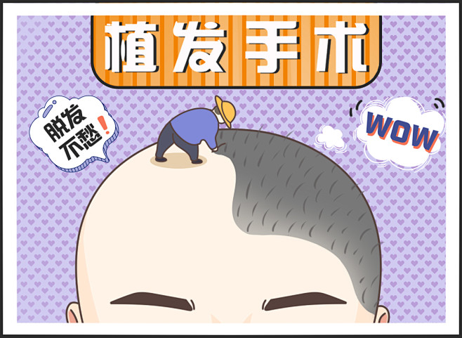 脱发 植发 脱发原因 病理性脱发 产后脱...