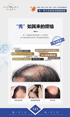 0IHt6ye3采集到植发
