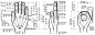 Stryker IVS Curette : Design development of the Stryker IVS Curette while at Tekna, Inc.