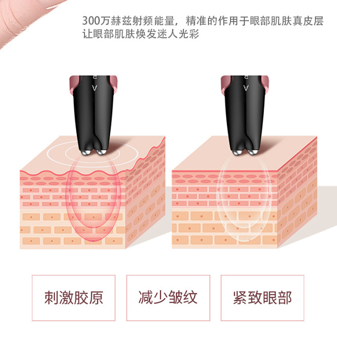 眼部按摩仪去眼袋皱纹射频美眼仪眼睛美容棒...