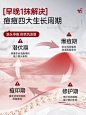 壬二酸祛痘膏复修淡化去痘印痘坑痘疤闭口青春痘凝胶水杨酸男生女-tmall.com天猫