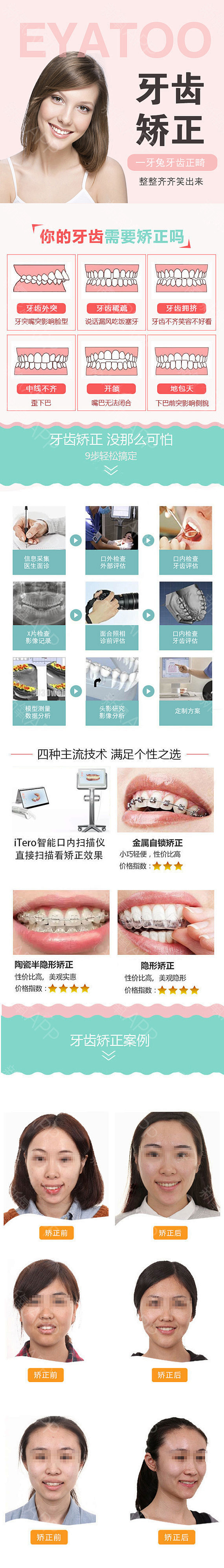 【金属托槽矫正】【金属托槽】到店咨询送洁...