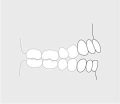 hnsylei采集到Tooth