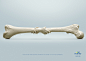 Forteo: Stronger Bones : Poster for an event called "Connecting For Care", bringing together leading health care professionals in order to find solutions and optimize care for Osteoporosis patients.