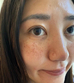栗米采集到肌肤问题