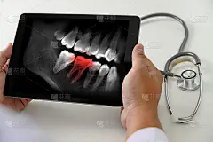 牙科医生牙科工具牙齿x光工作在电脑上看牙齿x光