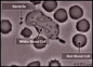 白细胞捕捉细菌