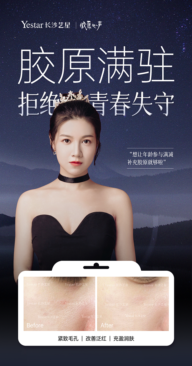 ‍♀️皮肤状态好真的超减龄～
#长沙艺星...