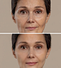antiaging-beauty-treatment-2-scaled.jpg (2290×2560)