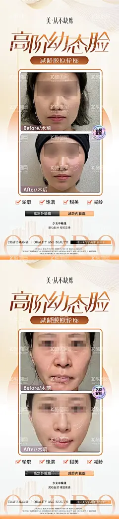 医美幼态脸案例  - 源文件下载【酷图网】海报,医美,美业,抗衰,幼态脸,轮廓固定,人物,案例,对比,