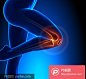 9张关节膝盖疼痛人物模型高清图片  - PS饭团网