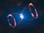 The material around SN 1987A (artist’s impression)