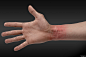 Mauricio Ruiz Design - NCIS: New Orleans - Wrist Scars : Some quick Concept Art of healed wrist scars found on a drowned soldier for NCIS: New Orleans.