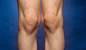 #绘画参考#【人体结构】【膝盖的结构】不就是个膝盖吗？送你一打！。(╯‵□′)╯︵┻━┻ ​​​​