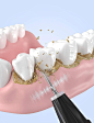 牙齿洗牙脉冲水波水流牙齿刷牙图片摄影图 (16)