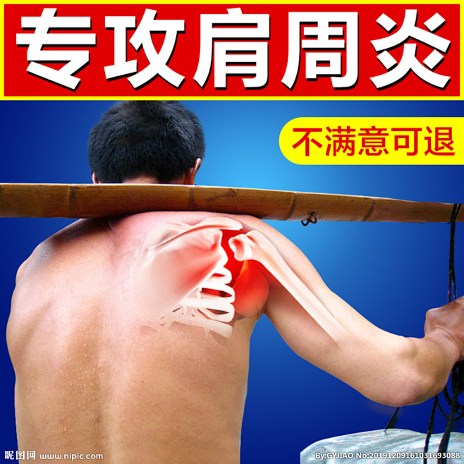 肩周炎