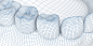 Wireframe illustration of teeth