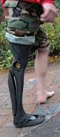 Bespoke Innovations | 3D-printed prosthetic limbs.