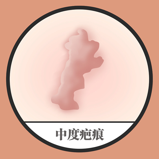 疤痕 疤痕消除 疤痕体质 疤痕增生如何消...