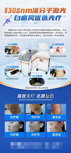 美国308医疗准分子白癜风医疗科技海