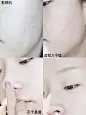 这个妆效的粉底液为什么这么便宜？！ 混油皮爱上了！开挂平价粉底液 : 这个妆效的粉底液为什么这么便宜？！ 混油皮爱上了！开挂平价粉底液，橘朵这个价格也太良心了，看了我喵的视频，引起舒适，下单后立马就分享给你们，上完妆后和肌肤融在一起的样子 我用的是他家沁润柔光粉底液#0