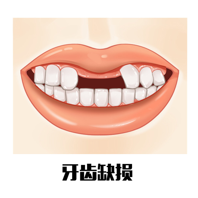 牙齿 口腔 漫画 插画 卡通 牙齿矫正 牙齿疾病 牙齿稀疏 牙齿错乱 反颌 牙列拥挤 中线不齐 开颌 牙齿缺损 深覆合 龅牙 牙齿不齐 偏颌 ...