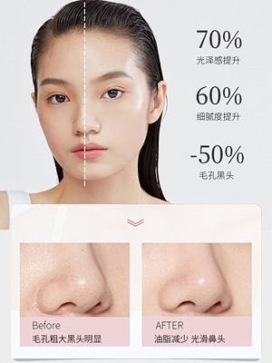 auou艾遇泥膜去黑头粉刺闭口收毛孔深层...