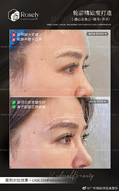 外夕采集到医美