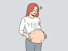 孕妇肚子上有妊娠纹插画图片素材_ID:437432551-Veer图库