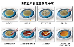 l安然anr々齐采集到眼科素材图片