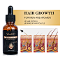 厂家直销100% 天然有机生姜自有品牌治疗脱发生长血清油 - Buy Hair Growth Oil,Private Label Hair Growth,Hair Growth Treatment Product on Alibaba.com
