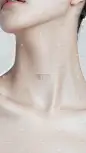 颈