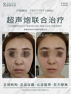 娜DADA采集到案例对比